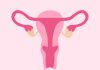 Polycystic Ovary Syndrome. Female Reproductive System With Ovarian Cysts