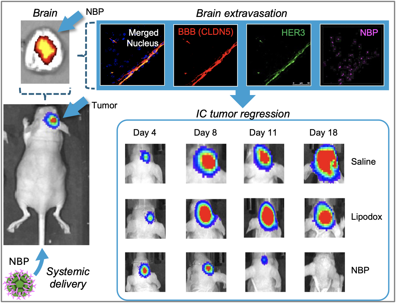 Fig. 3. NBPs delivered systemically cross the BBB and accumulate in intracranial tumors, causing tumor regression—systemic delivery of NBPs by tail vein injection results in the detection of NBPs in the brain. Microscopic examination of brain specimens shows that the NBPs can be detected outside of the brain vasculature (delineated by claudin 5; CLDN5), which also exhibits robust levels of HER3. NBPs delivering chemotherapy agents exhibit improved therapeutic efficacy compared to untargeted chemotherapy (lipodox).