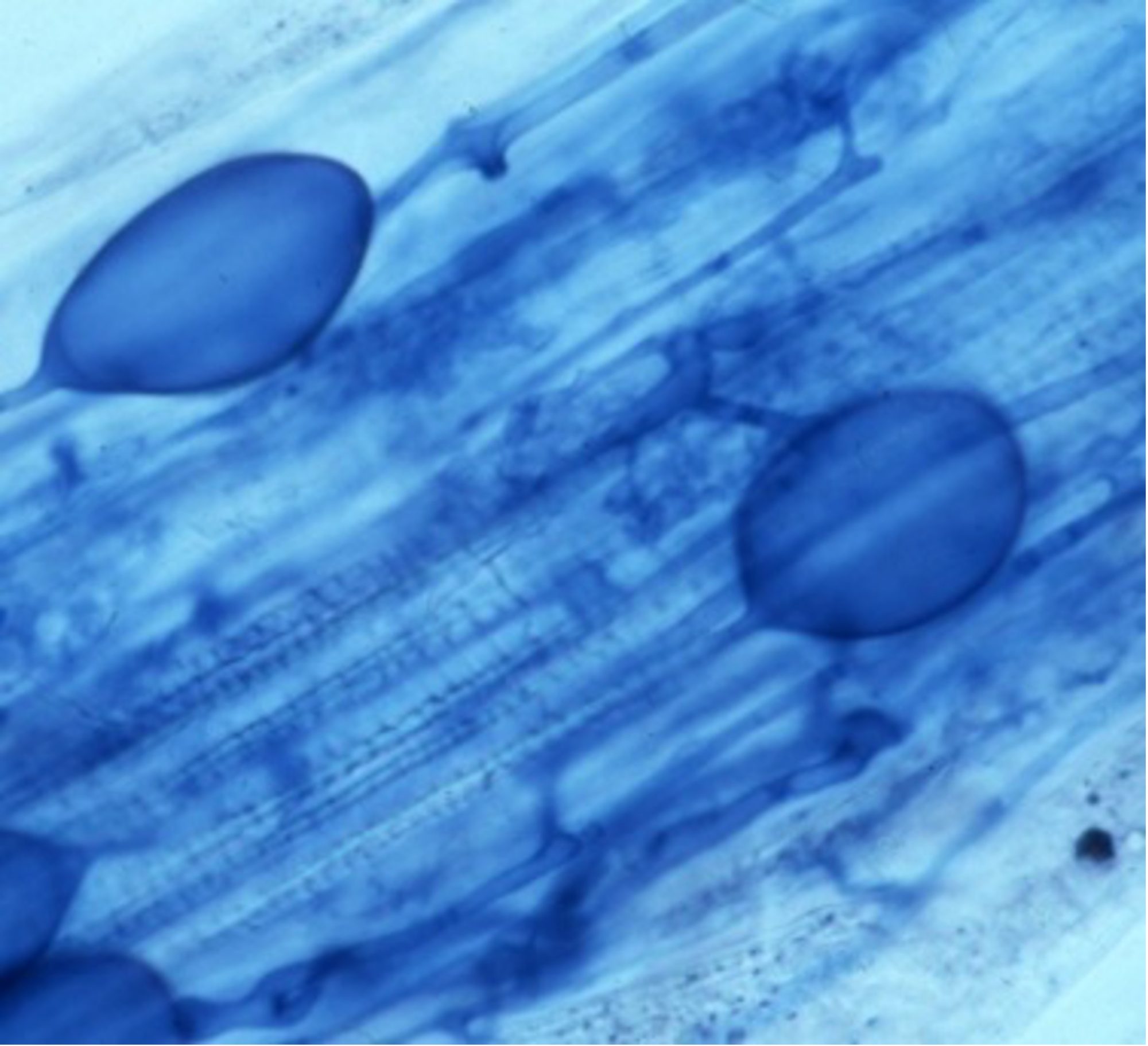 Arbuscular mycorrhizal fungi in roots - image: © UWA Institute of Agriculture Perth, Western Australia,