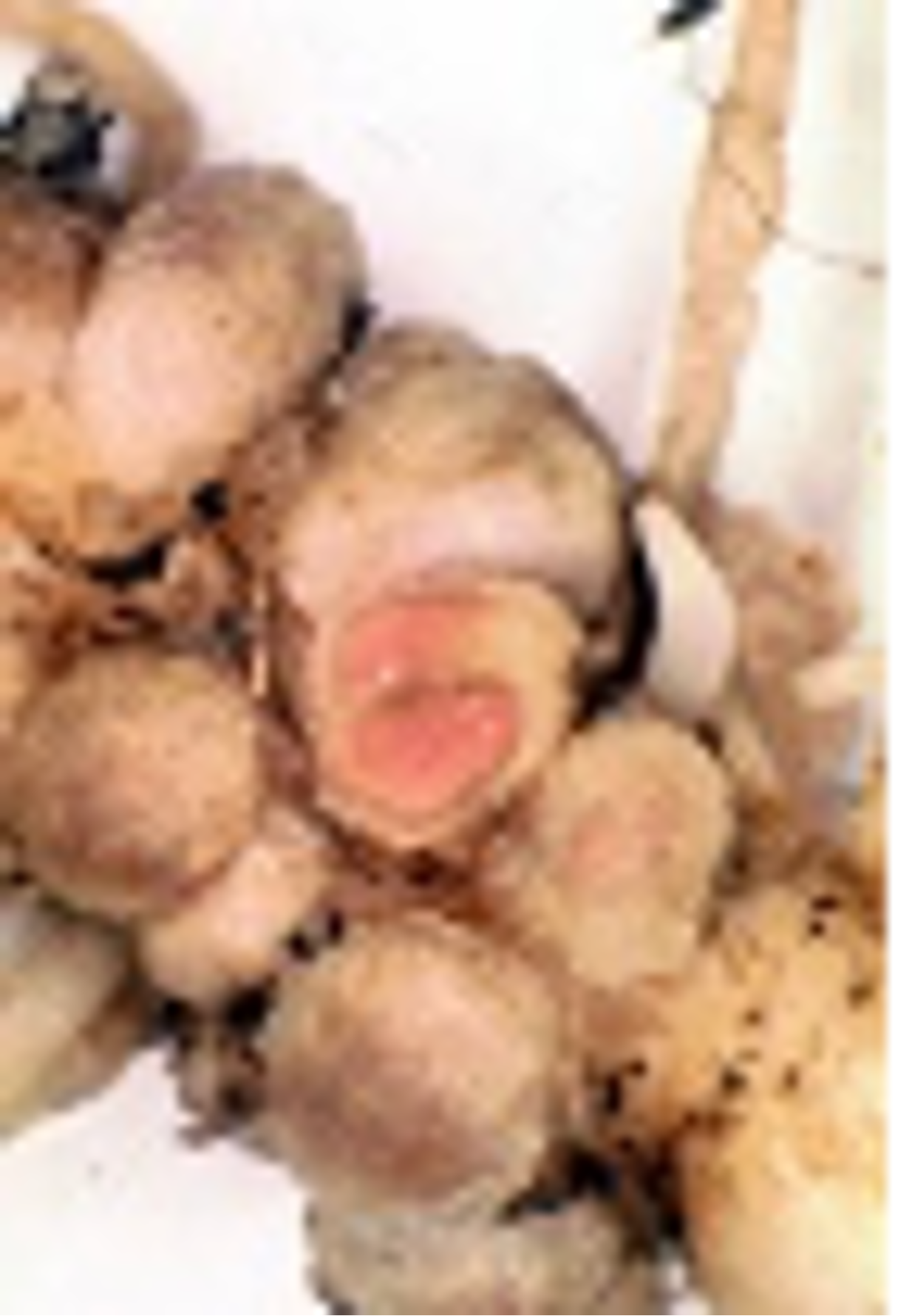 Root nodules containing rhizobia (bacteria) - image: © UWA Institute of Agriculture Perth, Western Australia,