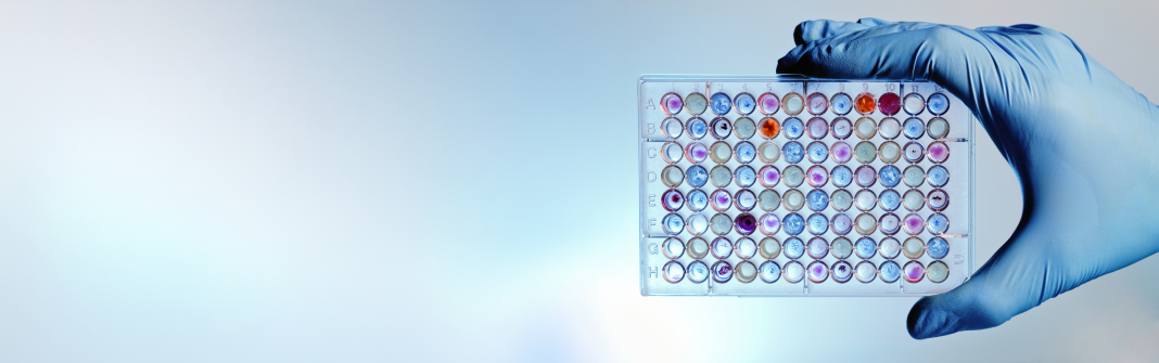 iStock-178513594 EXPANDED A hand with a microplate filled with color samples
