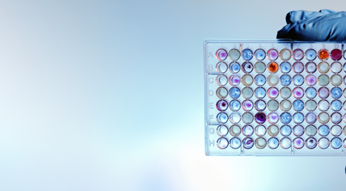 A hand with a microplate filled with color samples