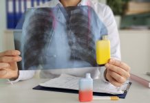 Doctor holds vape and X-ray lungs. Consequences of smoking vape electronic cigarettes. Harm of electronic cigarettes and influence of electronic cigarettes on human body