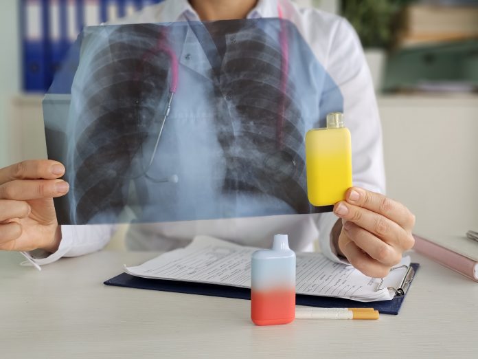 Doctor holds vape and X-ray lungs. Consequences of smoking vape electronic cigarettes. Harm of electronic cigarettes and influence of electronic cigarettes on human body