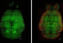 Light sheet fluorescence microscope images of mouse brains 12h after being treated (left) or not (right) with nanoparticles. The brains were analysed to see the amount of Aβ plaques accumulation. Red: Aβ plaques. Green: vessels from the blood brain barrier.