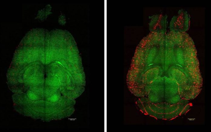 Light sheet fluorescence microscope images of mouse brains 12h after being treated (left) or not (right) with nanoparticles. The brains were analysed to see the amount of Aβ plaques accumulation. Red: Aβ plaques. Green: vessels from the blood brain barrier.