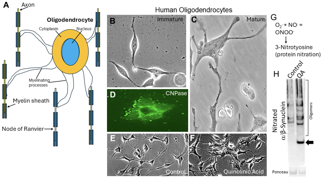 Figure 1. Human oligodendrocytes. A. Cartoon of oligodendrocyte myelination of neuronal axons. B-D. Oligodendrocytes grown in a dish (cell culture). E,F. Oligodendrocyte excitotoxicity. G. Peroxynitrite (ONOO) formation and protein damage. H. Oligodendrocyte excitotoxicity with quinolinic acid (QA) causes formation of toxic forms of α-synuclein as monomer (arrow) and oligomers. Ponceau shows equal protein loading in the lanes.