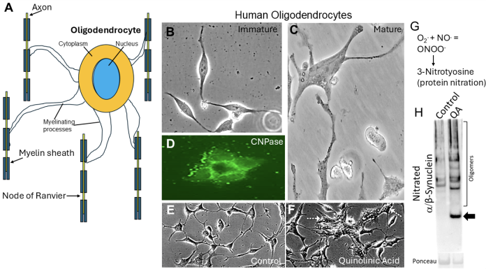 Figure 1. Human oligodendrocytes. A. Cartoon of oligodendrocyte myelination of neuronal axons. B-D. Oligodendrocytes grown in a dish (cell culture). E,F. Oligodendrocyte excitotoxicity. G. Peroxynitrite (ONOO) formation and protein damage. H. Oligodendrocyte excitotoxicity with quinolinic acid (QA) causes formation of toxic forms of α-synuclein as monomer (arrow) and oligomers. Ponceau shows equal protein loading in the lanes.