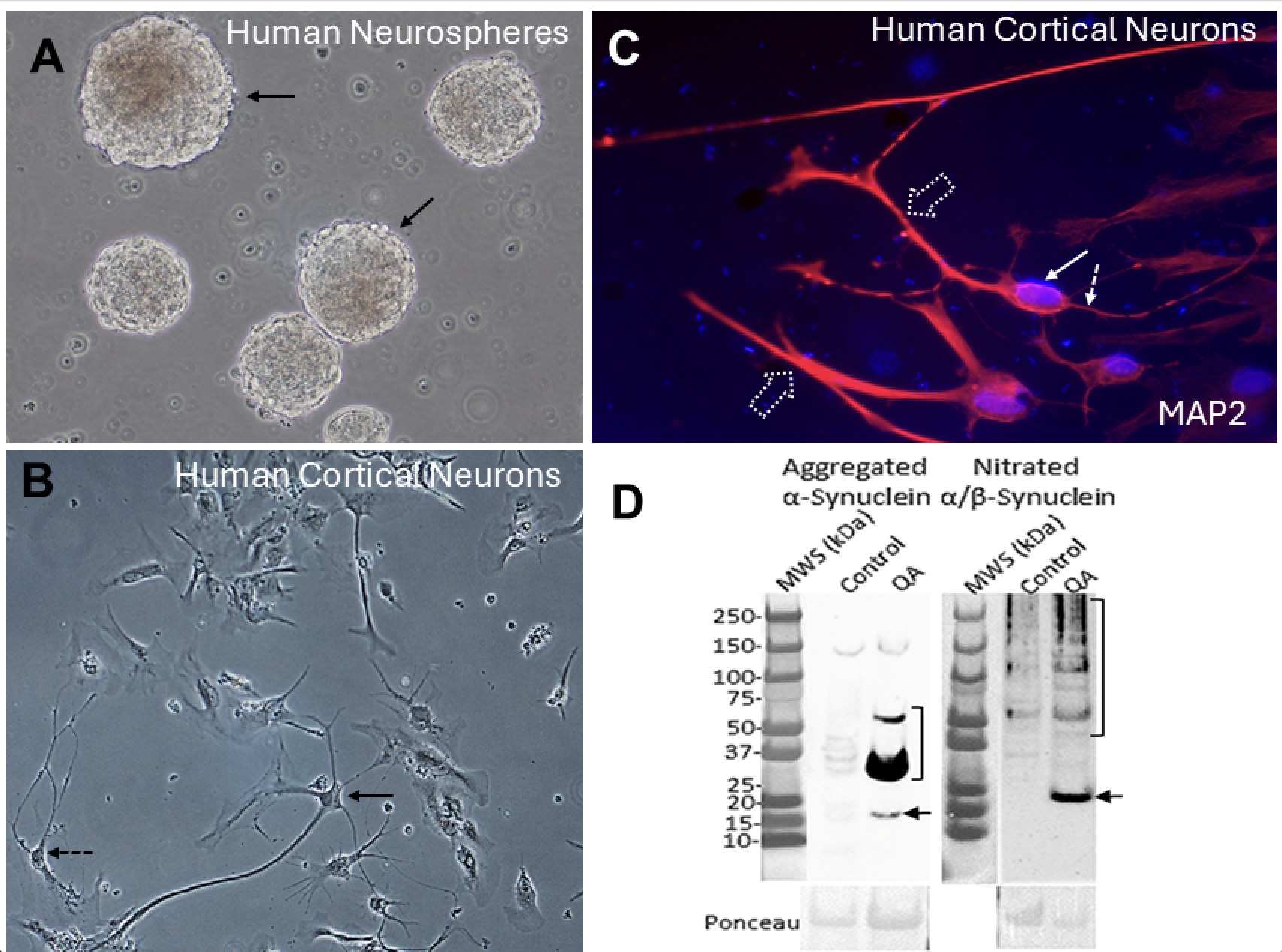 Figure 2. Human neurons. A. Undifferentiated neurospheres (arrows) grown in a dish. B. Differentiated cortical neurons as pyramidal-like (arrow) and interneuron-like (dashed arrow) neurons. C. Microtubule-associated protein-2 identifies these cells as neurons with their cell body (solid arrow), axon (dashed arrow), and dendrites (open dashed arrows). D. Excitotoxicity in neurons with quinolinic acid (QA) causes formation of toxic forms of aggregated α-synuclein (left) as monomer (arrow) and oligomers (bracket) and nitrated synuclein (right) and monomer (arrow) and oligomers (bracket). Ponceau shows equal protein loading in the gels.