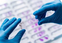 Hand in blue glove holding glass histology slides.