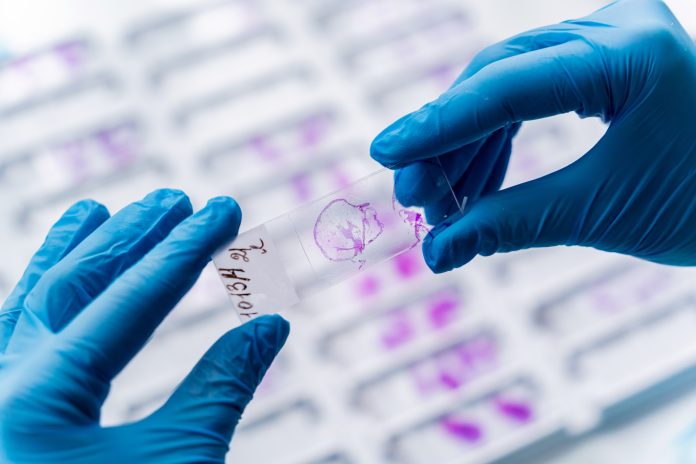 Hand in blue glove holding glass histology slides.