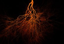 Saving lives from cardiovascular diseases in Africa Blood vessels on black background