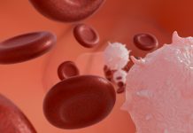 Abnormal or cancerous white blood cells and scattered healthy red blood cells.