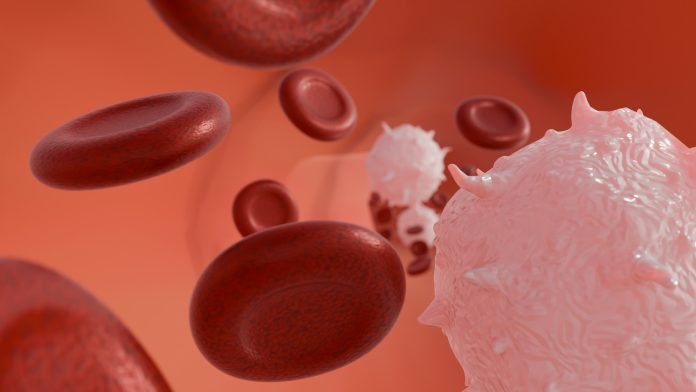 Abnormal or cancerous white blood cells and scattered healthy red blood cells.