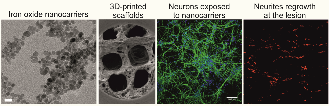 Figure 3. Snapshots of relevant advances in the project, including the design of therapeutic nanocarriers, 3D-printed scaffolds, biocompatibility assessment in vitro, and promising regenerative features in an experimental model of SCI in rats.