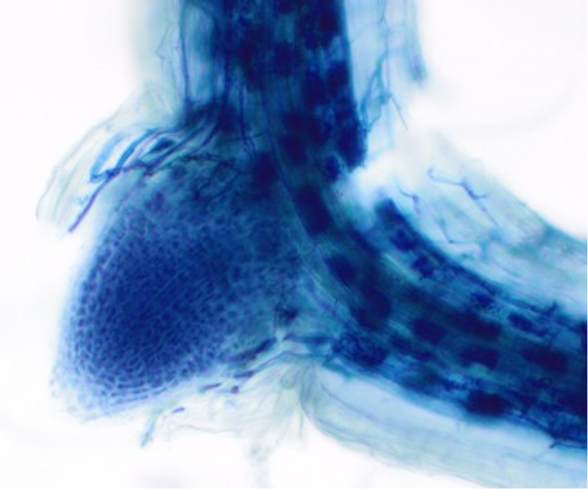 Photo 4. A nodule emerging from a legumeroot colonised by arbuscular mycorrhizal fungi (stained with Trypan Blue). Source: Lynette Abbott