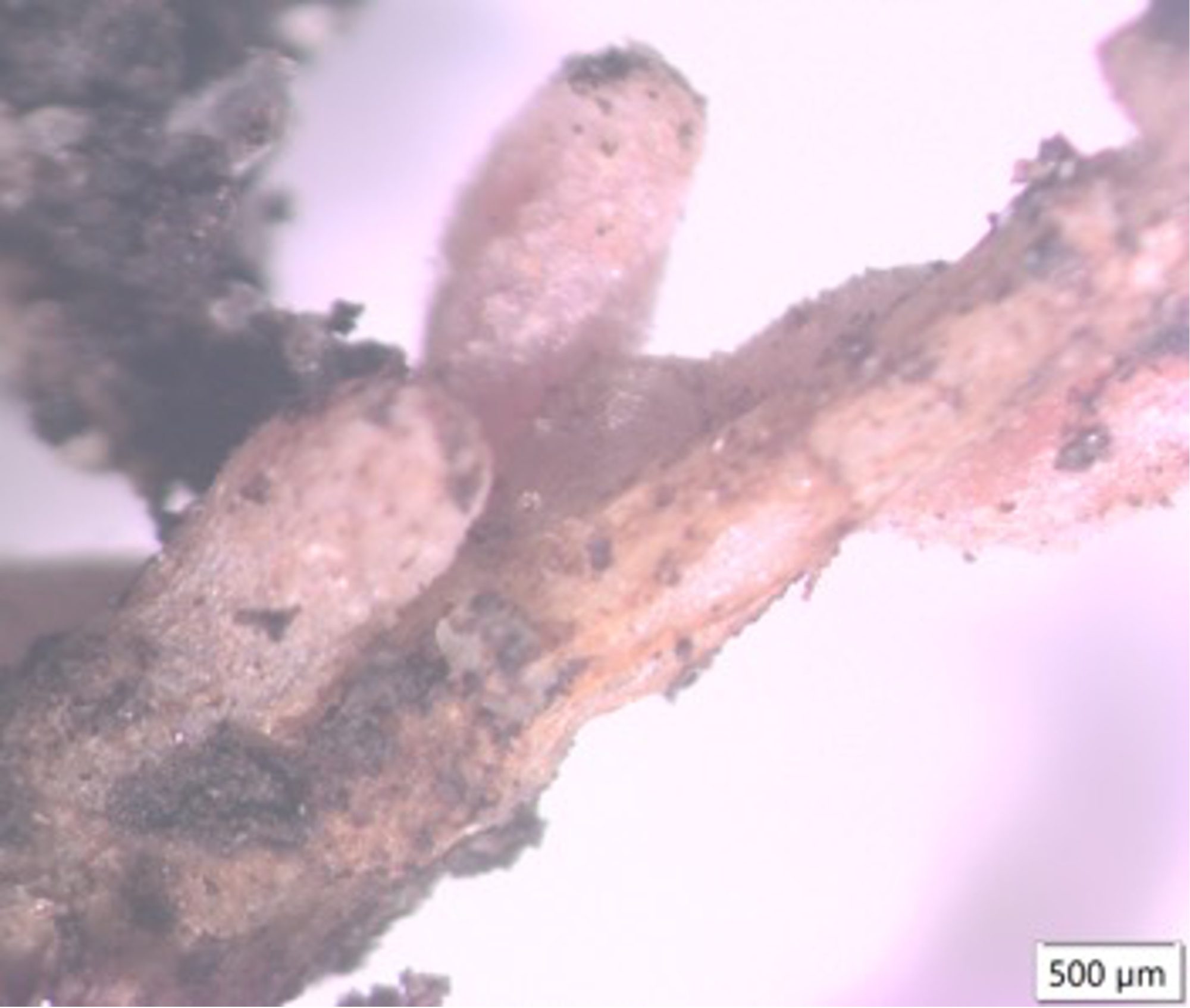 Photo 5. A root of Medicago sp with twonodules which contain bacteria which can fix atmospheric nitrogen. Source: Lynette Abbott
