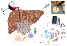 Liver regeneration in alcohol related liver disease Image: © Created in BioRender. Kimer, N. (2025) https://BioRender.com/ fi22c5v