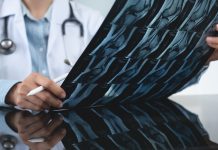 Orthopedics surgeon doctor examining patient's knee joint x-ray films, MRI bone, ct scan in at radiology orthopedic unit in hospital. knee joint film x ray, close up