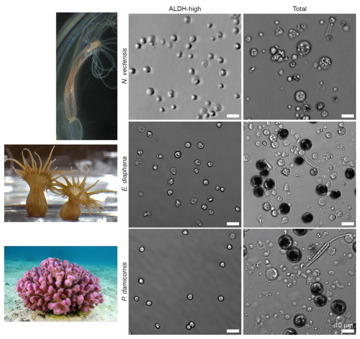 Figure 3: ALDH-high cells in Hexacorallia.Hexacorallia is a group of species that includes stony corals and sea anemones. This image compares cells from three different marine creatures: a sea anemone (Nematostella vectensis), another anemone (Exaiptasia diaphana), and a coral (Pocillopora damicornis). On the left, you see photos of the animals. The panels on the right show cells isolated from each one, where the scientists have separated out a special group called “ALDH-high” cells and compared them to all the other cells (“Total”). The “ALDH-high” cells show a similar shape over these three related species, compared to images of the “Total” cells population that exhibit a variety of cellular shapes (Talice et al., 2024).