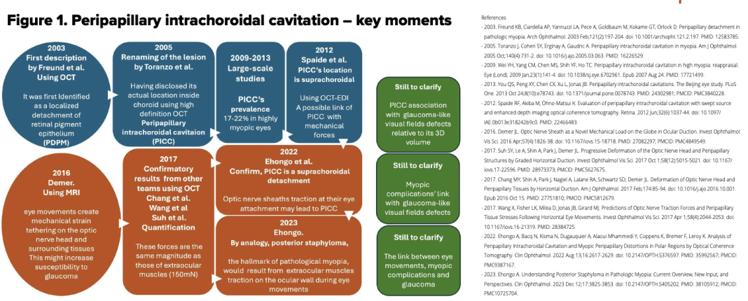 Figure 1. Peripapillary intrachoroidal cavitation – key moments
