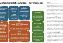 Figure 1. Peripapillary intrachoroidal cavitation – key moments