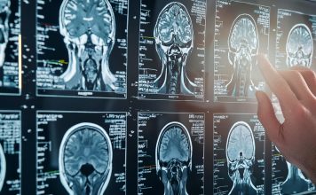 MRI Brain Scan. Doctor shows MRI Brain Scan of head and skull.