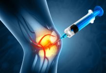 Injection into the knee joint. Drug treatment method for alleviating knee injuries in human. 3d illustration